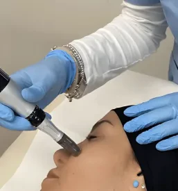 Microneedling Obala, Portorož