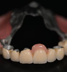 Estetska zobna protetika Dental Spectrum