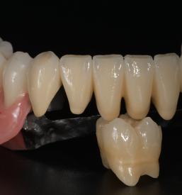 Celovite rešitve na področju dentalne estetike Ljubljana