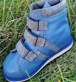 Izdelava ortopedskih vložkov Slovenija