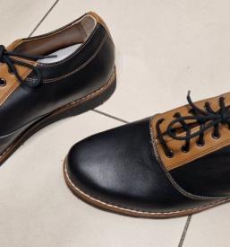 Izdelava ortopedskih vložkov Ljubljana, okolica, Slovenija