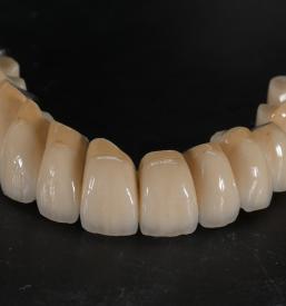 Kvalitetne zobne luske v Ljubljani