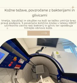Hiperbarična kisikova terapija Kamnik, okolica