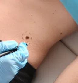 Dermatološka ambulanta na Obali