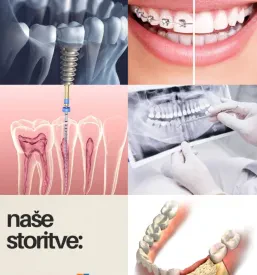 Invisalign zdravljenje Ljubljana