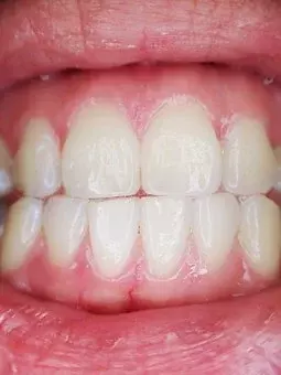 zasebni zobni laboratorij maribor 1
